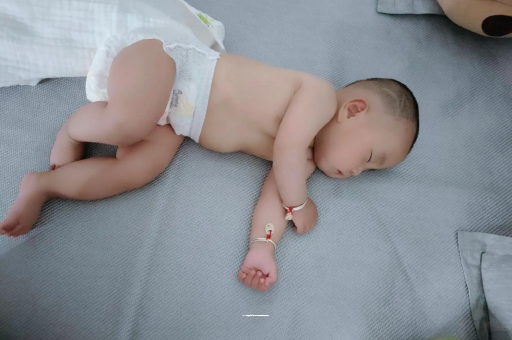 广水宝宝头上长痱子